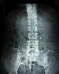 Photo of: xray spine